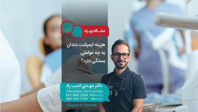 هزینه ایمپلنت دندان به چه عواملی بستگی دارد؟