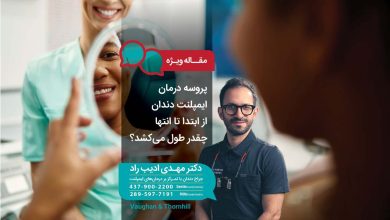 پروسه درمان ایمپلنت دندان از ابتدا تا انتها چقدر طول می‌کشد