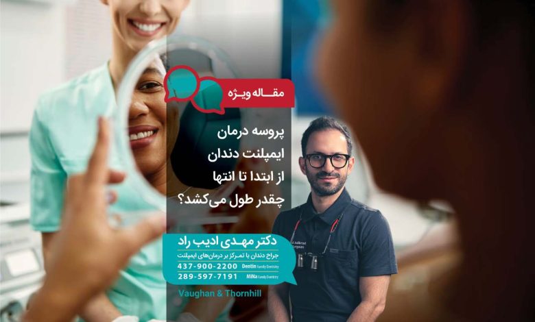 پروسه درمان ایمپلنت دندان از ابتدا تا انتها چقدر طول می‌کشد
