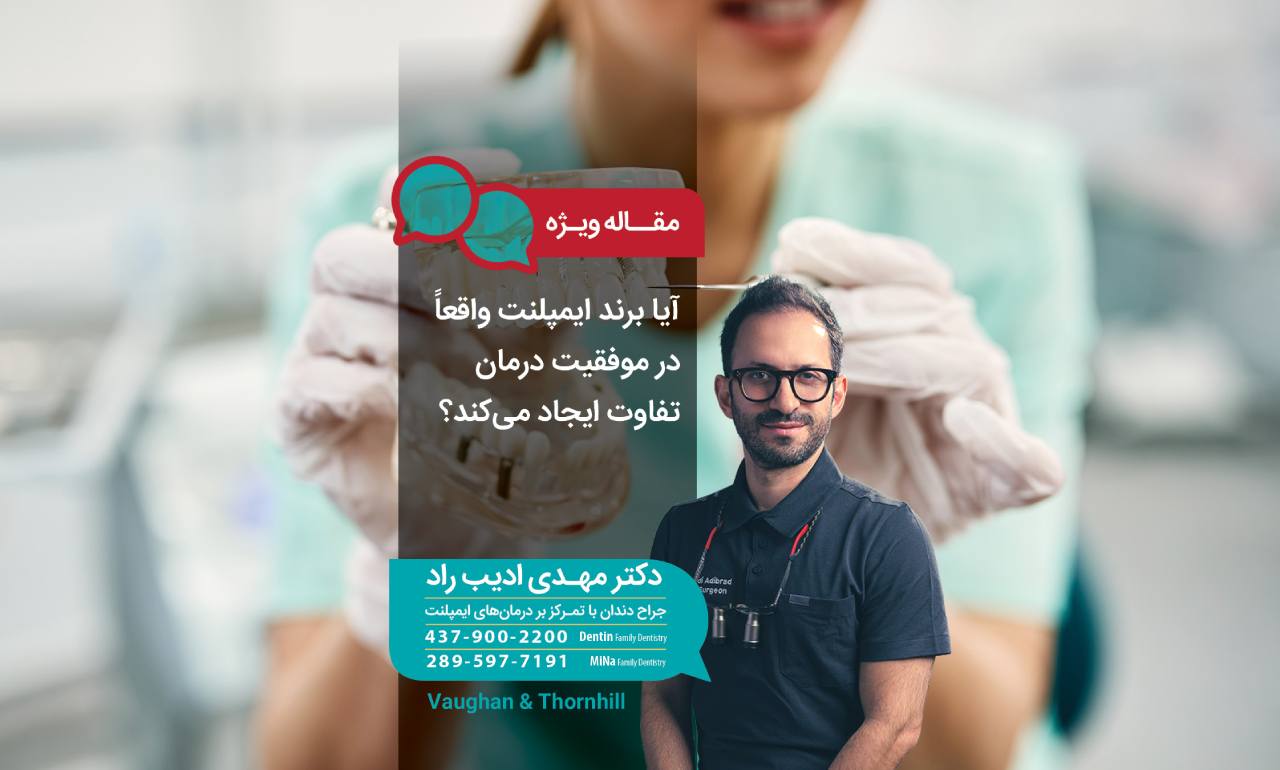 آیا برند ایمپلنت واقعاً در موفقیت درمان تفاوت ایجاد میکند؟